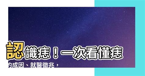 內痣是什麼|痣是什麼？一次了解痣原因、就醫時機以及如何改善